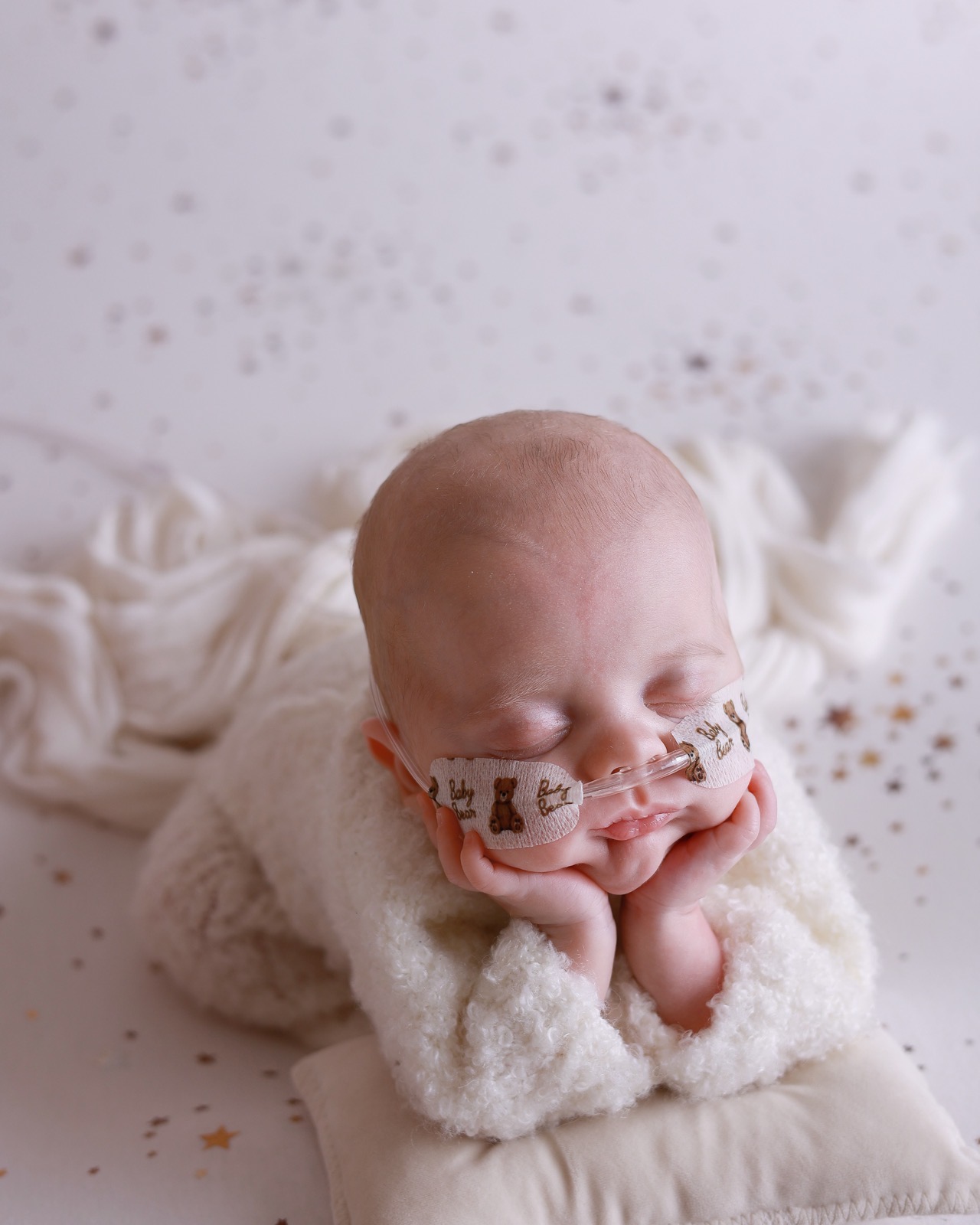 Sleeping newborn boy resting his chin on his hands, wearing a nasal cannula, cream knitted outfit, star-speckled backdrop