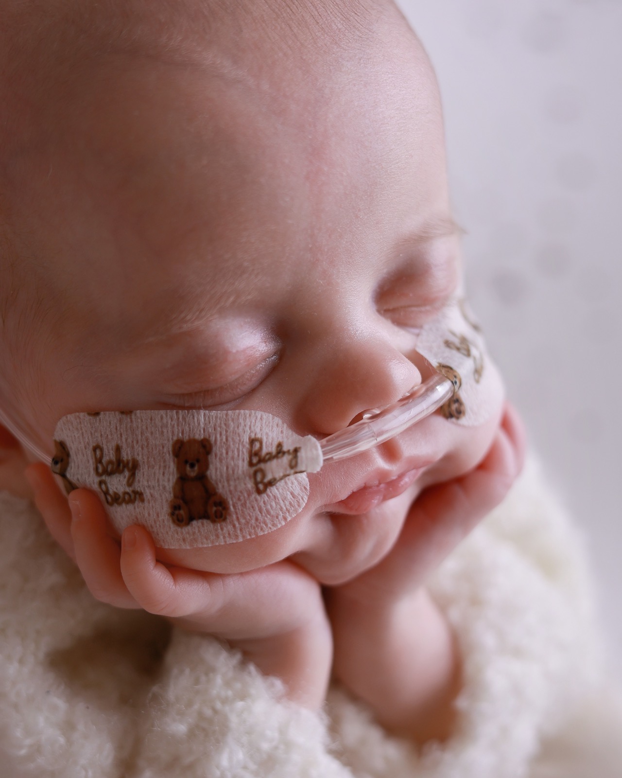 Extreme close-up of a sleeping newborn's face with a nasal cannula taped in place, hands resting near his chin